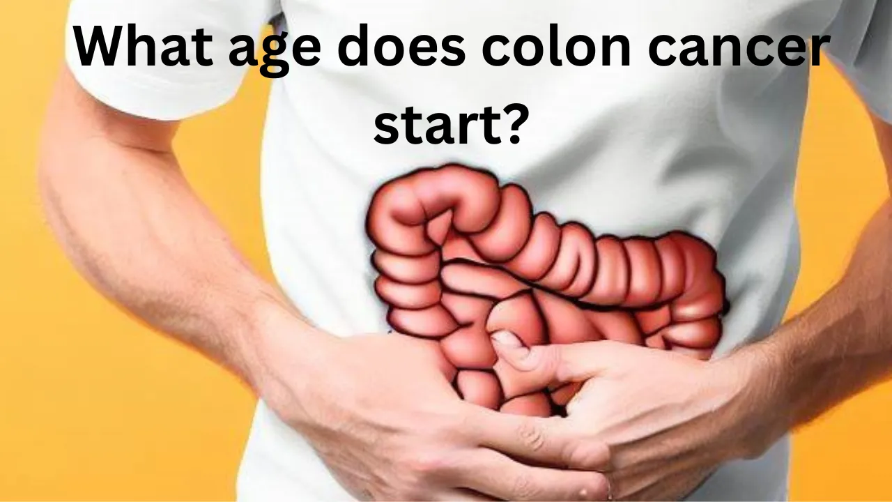 What age does colon cancer start?